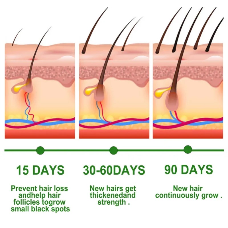 Soro de crescimento capilar, c - Beard Oil Growth avaliação e preço