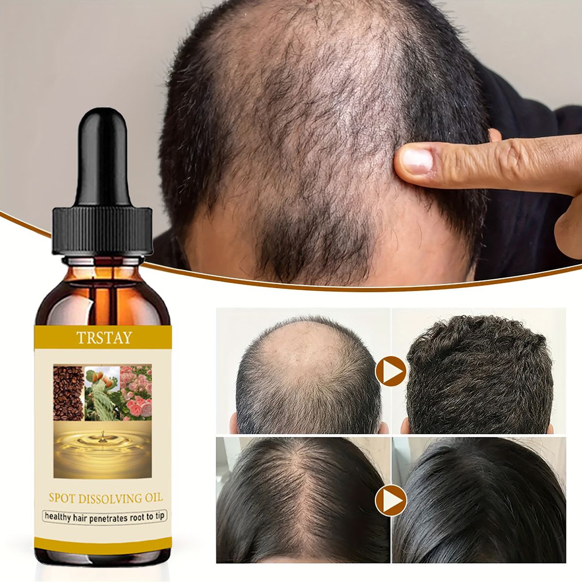 50ml óleo de crescimento de ba - Beard Oil Growth avaliação e preço
